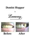 Dentist Hopper